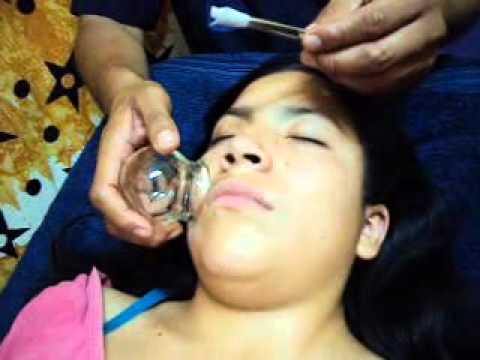 REFLEXOLOGIA PERÙ VENTOSAS ( PARTE