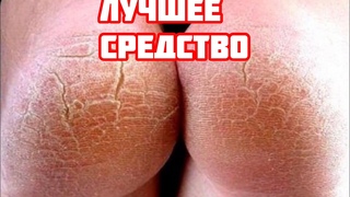 Копеечное средство из Аптеки от трещин на пятках, мозолей, натоптышей