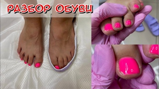 Разбор обуви / Скалывается гель лак / Почему / Сухая кожа на пальцах ног что делать