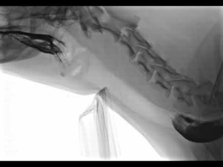 Собака, глотающая пищу (рентгеноскопия) / A Dog Swallowing Food (Fluoroscopy)