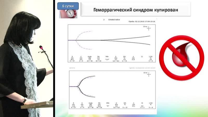 И. Э. АППАЗОВА, Массивные кровотечения в акушерско